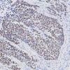 Anti-P53 Mouse Mab para IHC Se a pesquisa de câncer